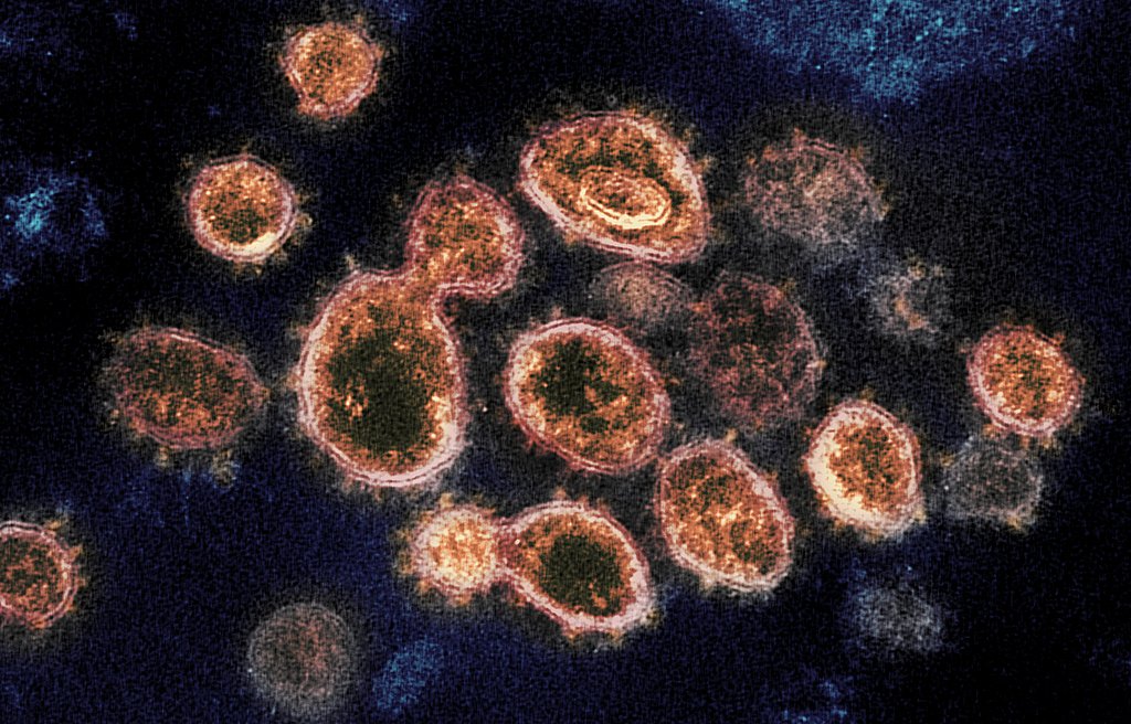 Bild des Coronavirus SARS-CoV-2 unter einem Transmissionselektronenmikroskop