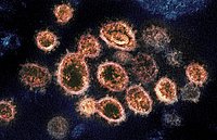 Bild des Coronavirus SARS-CoV-2 unter einem Transmissionselektronenmikroskop